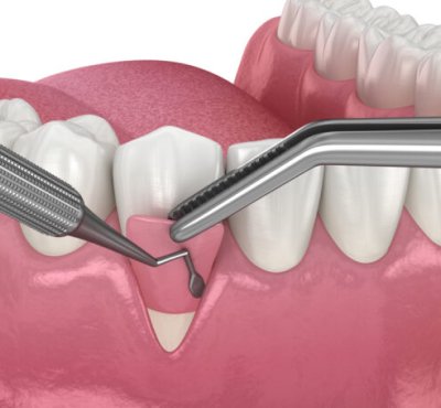 Dental Examination